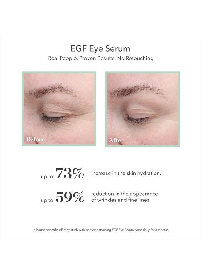 BIOEFFECT EGF Eye Serum with De-Puffer Rollerball, Anti-Aging, Moisturizing Contour Gel To Visibly Reduce Wrinkles, Puffiness, Fine Lines with Barley Growth-Factor Protein