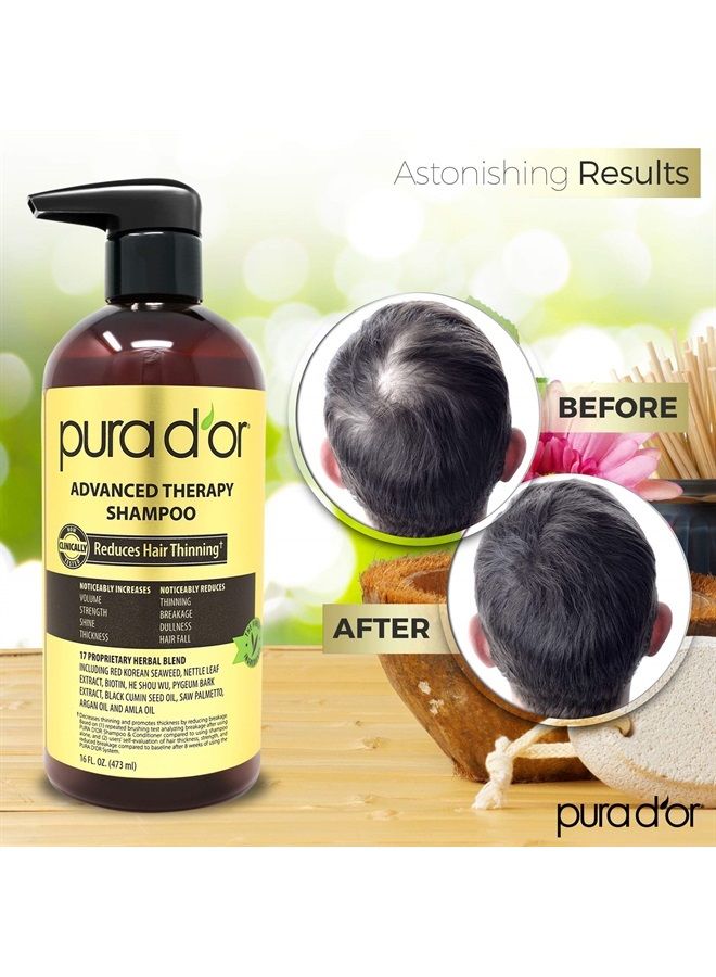 Advanced Therapy Shampoo (16oz) Reduces Hair Thinning & Increases Volume, No Sulfate, Biotin Shampoo Infused with Argan Oil, Aloe Vera for All Hair Types, Men & Women (Packaging May Vary)
