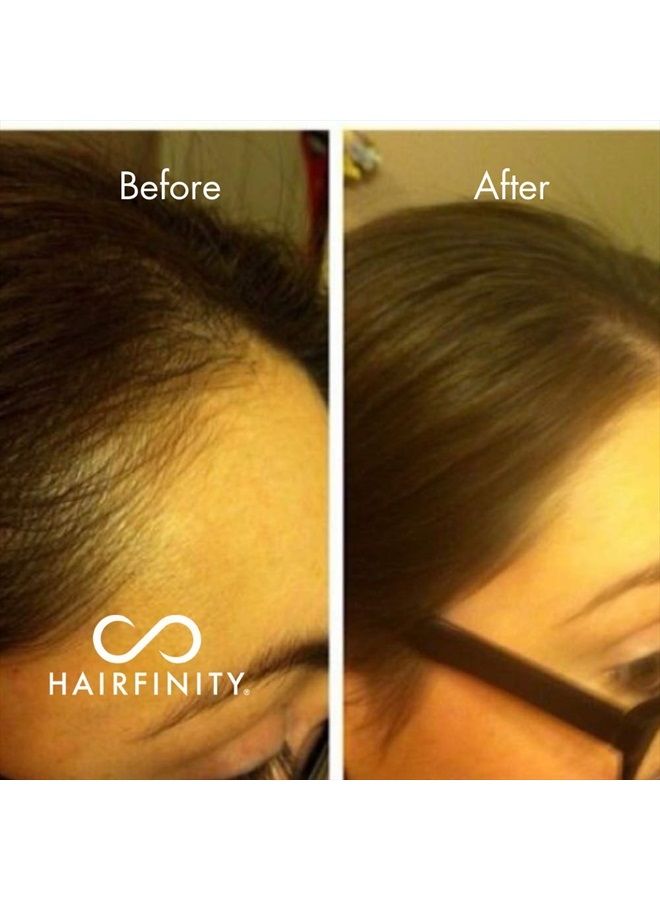 Infinite Edges Hair Serum - Hair Growth Treatment to Prevent Hair Loss and Stimulate Hair Follicles to Stop Hair Loss and Regrow Hair - Targets Causes of Alopecia - Sulfate & Silicone Free