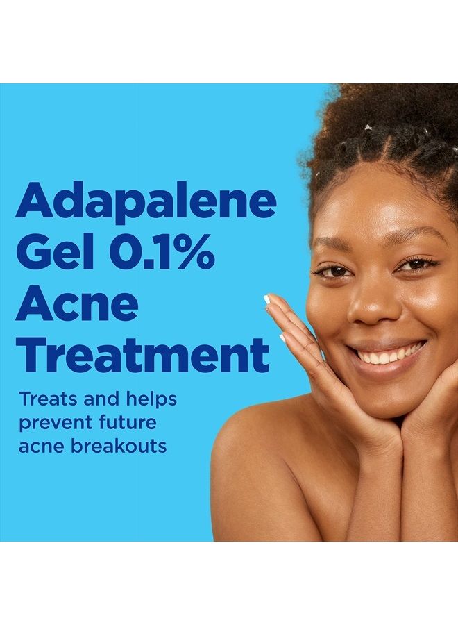 Acne Treatment Gel, 90 Day Supply, Retinoid Treatment for Face with 0.1% Adapalene, Gentle Skin Care for Acne Prone Sensitive Skin, 45g Pump (Packaging May Vary)