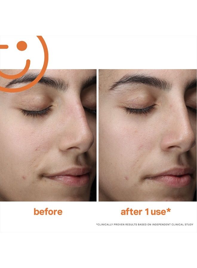 ExfoliKate Cleanser – Daily Exfoliating Foaming Face Wash – Clinically Formulated Glycolic Acid and Lactic Acid Gentle Facial Scrub, 4 Fl Oz