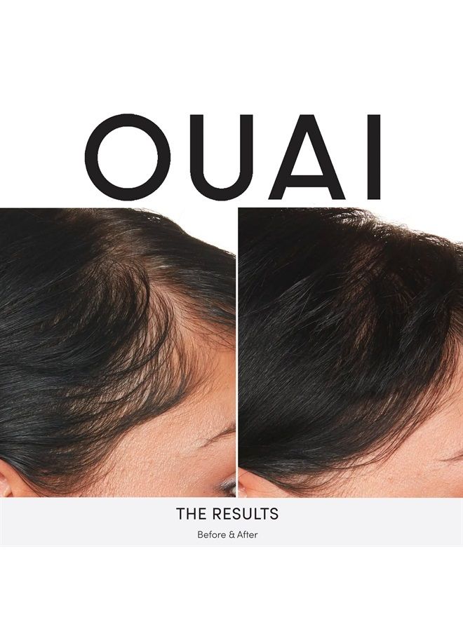 Scalp Serum with Balancing, Hydrating Formula for Thicker and Fuller Looking Hair (2 Fl Oz)