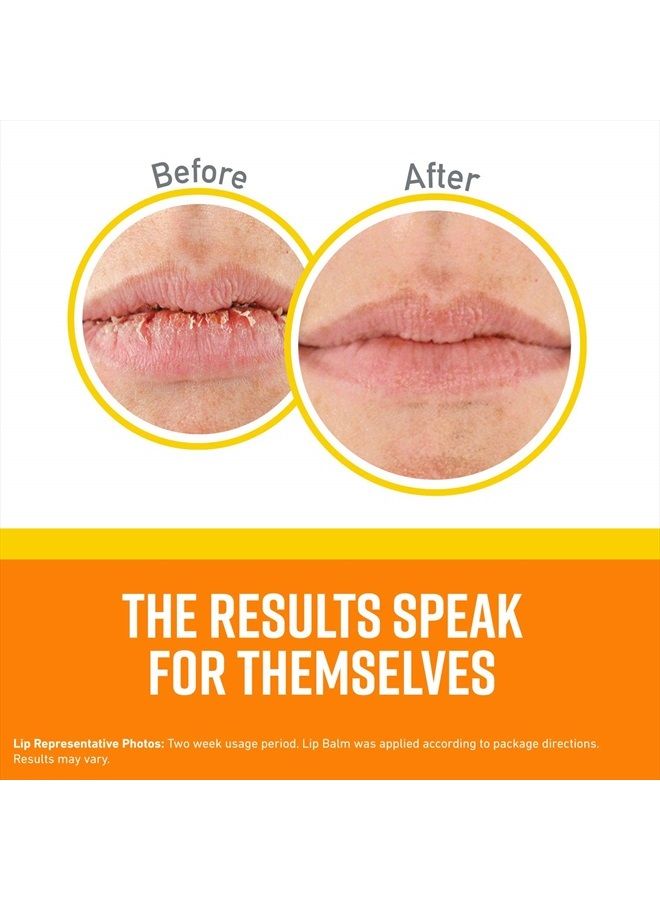 Lip Repair SPF 35 Lip Balm Stick, (Pack of 1)