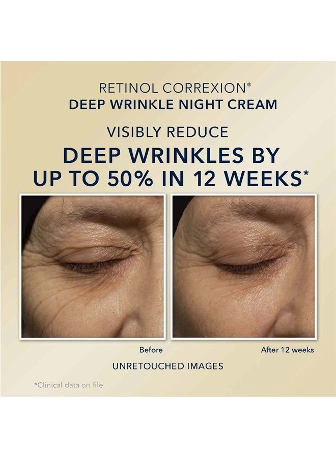 Retinol Correxion Value Set Duo, Deep Wrinkle Anti-Aging Night Face Cream + Daily Under Eye Cream for Dark Circles & Puffiness, Moisturizer
