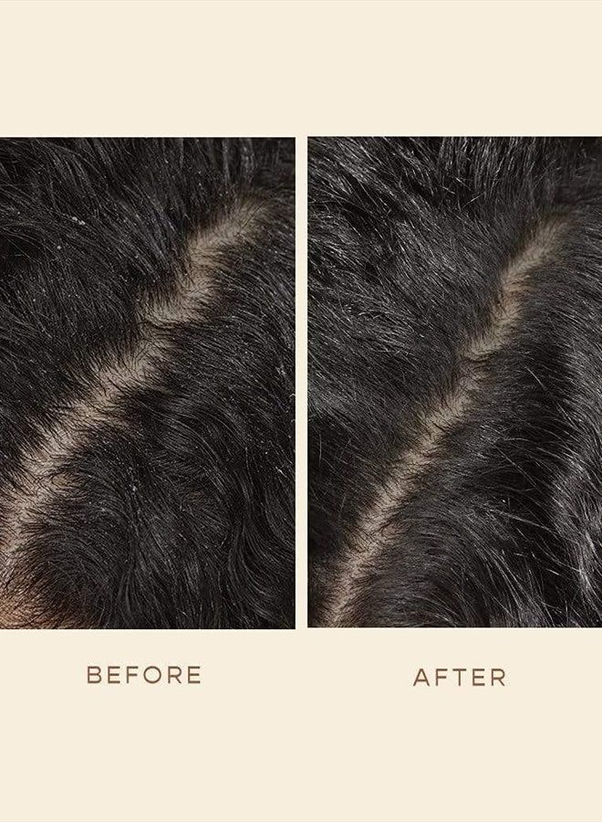 GRO Scalp Detoxifying Serum - Scalp Exfoliator Hair Serum with Zinc PCA, Omega 6 & 9 and Caffeine - Scalp Serum