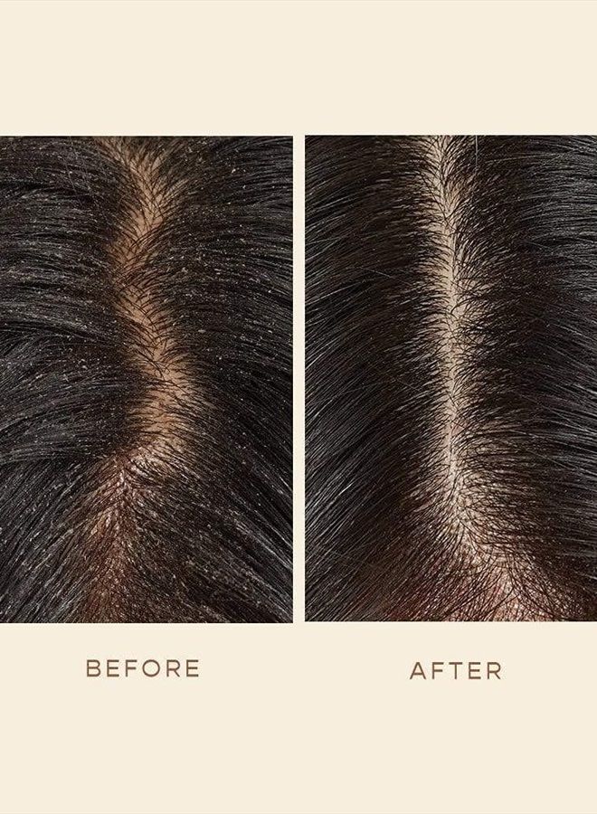 GRO Scalp Detoxifying Serum - Scalp Exfoliator Hair Serum with Zinc PCA, Omega 6 & 9 and Caffeine - Scalp Serum