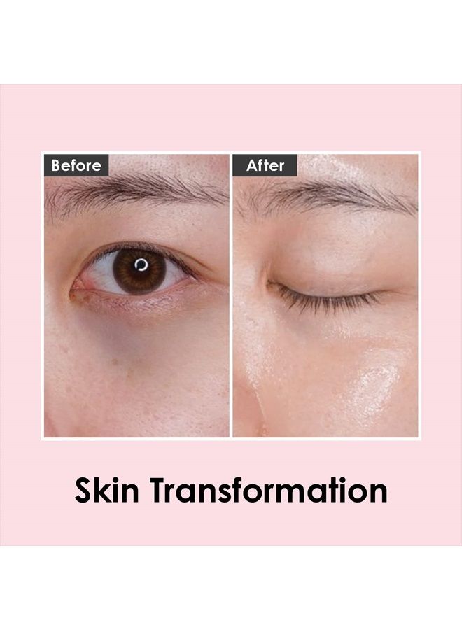 MEDI-PEEL Rose Peptide9 Ampoule Eye Patch 1.6g x 60 piece | Premium Hydrating Eye Patch, Anti-Wrinkle and Anti-Aging | Korean Skincare, For All Skin Types