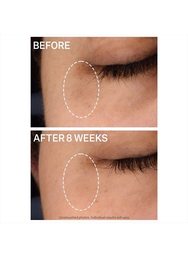 Super C Dark Circle Brightening Eye Serum, 0.5 oz