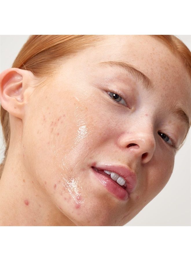 Apple Cider Vinegar Acid Peel, Exfoliating AHAs Even Skin Tone, Reduce Redness and Minimize Pores, 1.01 Fl Oz