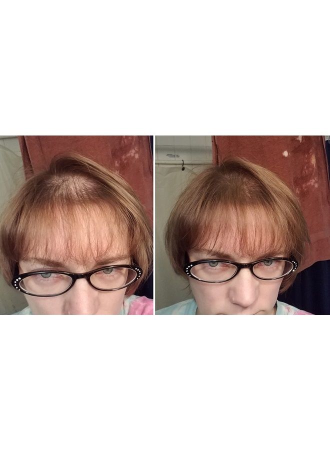 Hair Loss Concealer. Makes Thin Hair Look 10X Fuller Instantly. Eliminates Bald Spot and Thinning Hair (30G, 90-Day Supply). Light Brown