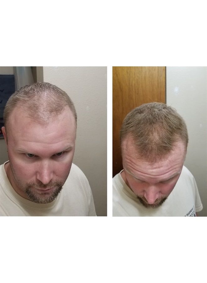 Hair Loss Concealer. Makes Thin Hair Look 10X Fuller Instantly. Eliminates Bald Spot and Thinning Hair (30G, 90-Day Supply). Light Brown