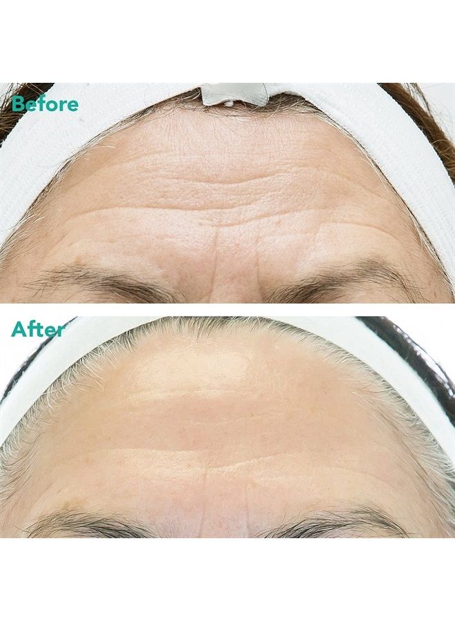 Rejuran® Advanced Anti-Aging Retinol + c-PDRN® Serum for Face and Neck – Triple Action with c-PDRN®, Retinol, and Peptides