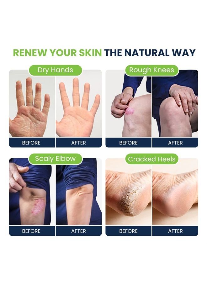 Tea Tree Oil Foot Cream - Moisturizing Athletes Foot Care For Dry Cracked Feet Cream - Heel & Callus Removal, Toenail Treatment, Ringworm Itchiness Relief - Made in USA (Foot Cream, 2 Ounce (Pack of 1