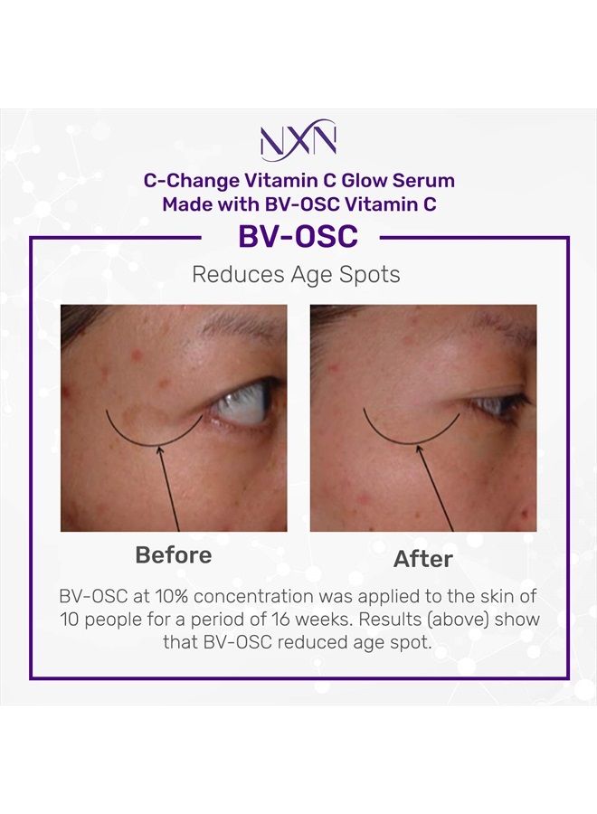 NxN Vitamin C & Hyaluronic Acid Serum Set, Clinically Proven to Brighten Skin, Reduce Dark Spots, Improve Hyper Pigmentation Age Spots, Reduce Fine Lines & Wrinkles - 1fl oz Face Kit