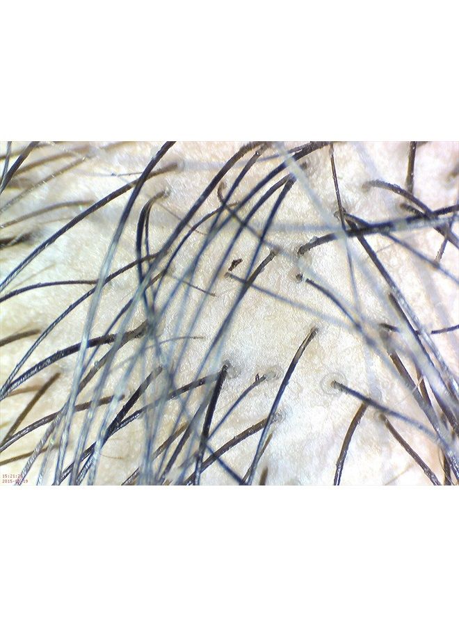 DE300 Digital Dermatoscope for Telehealth, Telemedicine, Dermatology, Trichology, and Skin Care. F.D.A. and C.E. Certified.