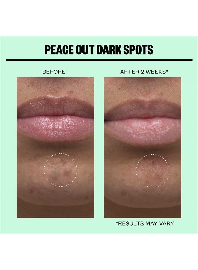 Peace Out Skincare Dark Spots. Dissolving Microneedling Dots to Reduce the Appearance of Dark Spots and Reveal Clear, Even Skin (12 dots)