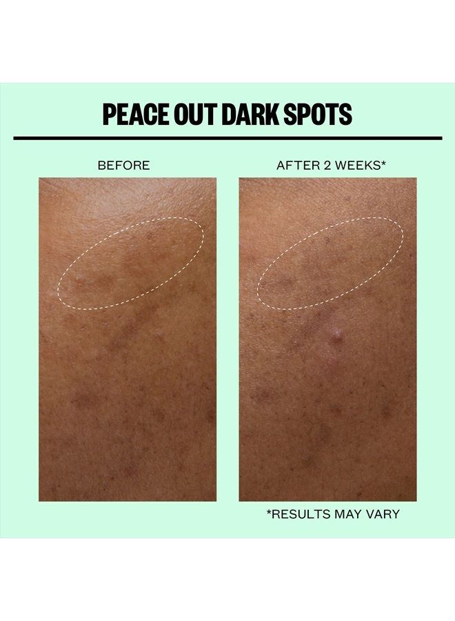 Peace Out Skincare Dark Spots. Dissolving Microneedling Dots to Reduce the Appearance of Dark Spots and Reveal Clear, Even Skin (12 dots)