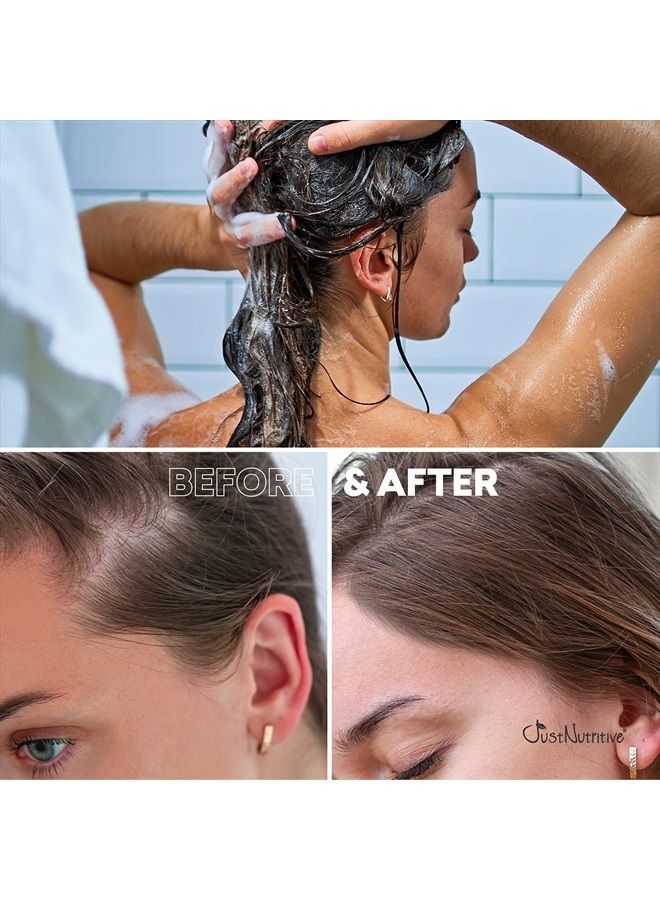 Hair Loss Shampoo | Hair Regrowth Shampoo For Thinning Hair | Hair Growth Product For Men and Women | Just Nutritive | 16 Oz