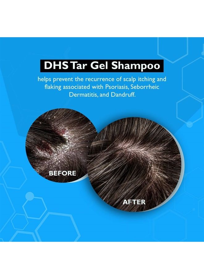 Person & Covey, Inc T Gel Shampoo - Anti Dandruff Shampoo, Mildly Scented Psoriasis Shampoo - Refined Coal Tar Shampoo Gel Formula, Scalp Psoriasis Shampoo, Deep Cleansing Rich Lather - 8 Fl. Oz.