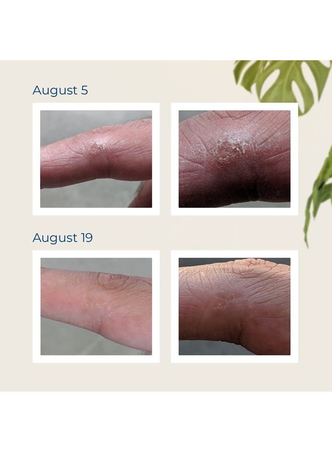 Shielding Lotion (3 Pack 3.4oz Tube)