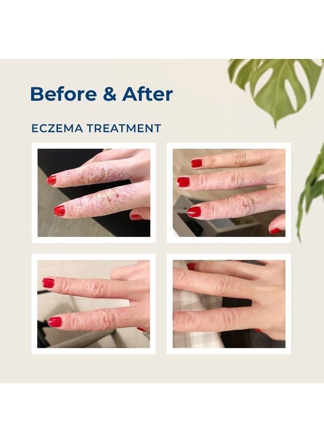 Shielding Lotion (3 Pack 3.4oz Tube)