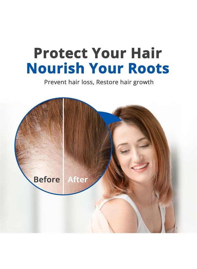 ® Topical Hair Serum for Hair Regrowth, Hair Loss Products with Extracted Saw Palmetto Oil for Bald Spots, Soothes Dry and Itchy Scalp, Non-Oily, Peppermint Scent, 118 mL Bottle