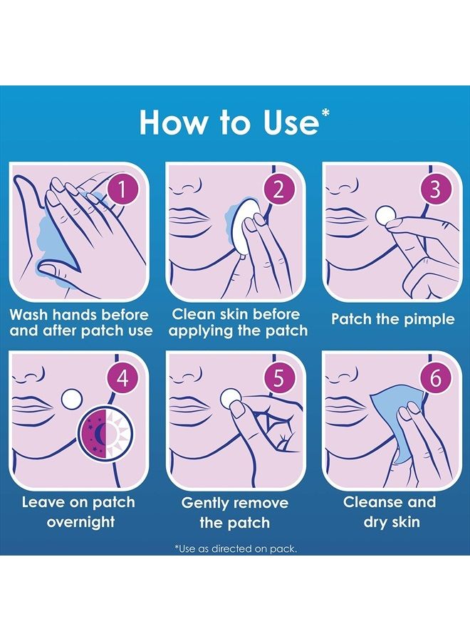 Overnight Spot Patches, Advanced Healing Hydrocolloid Acne Pimple Treatment, Blemish Spot Stickers for Face, 18 count