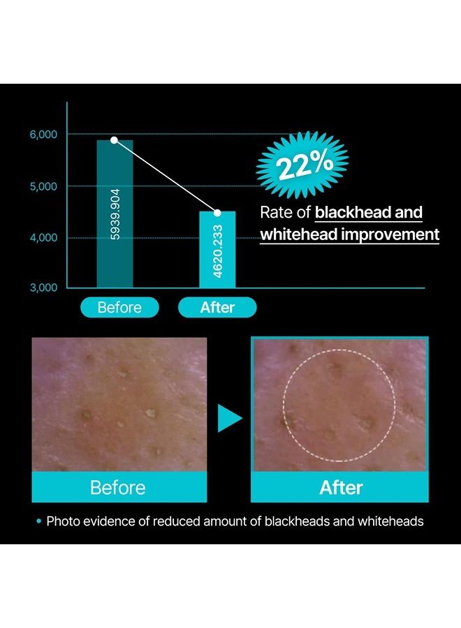 Pore Blackhead One Shot | Sebum and Blackhead Remover Mask | Clay Mask for Blackheads and Pores | Korean Skincare Pore Minimizer & Nose Blackhead Remover | Whitehead Remover (3.53 Fl Oz)