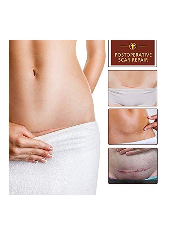 2-Piece Tcm Scar And Acne Mark Removal Gel Ointment Set 30grams