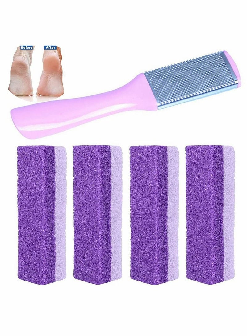 Pu Foot Grinding Stone Pumice Exfoliating Callus Dead Hard Skin Remover File Scrubber Pedicure Care Tool Foam Beauty New Pattern Two-color Stone, 5 Pcs
