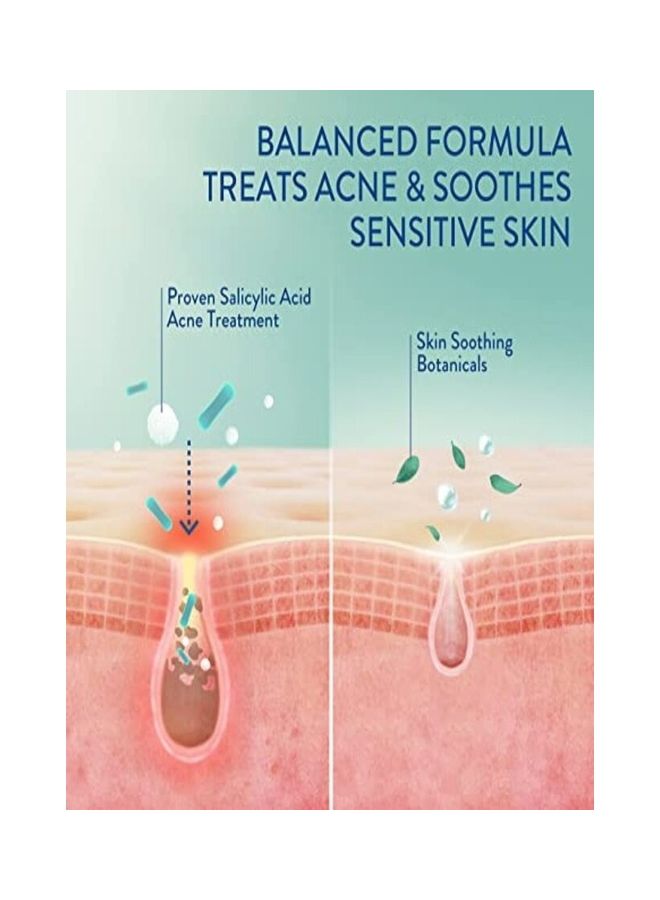 Gentle Clear Clarifying Acne Cream Cleanser Face Wash 124ml