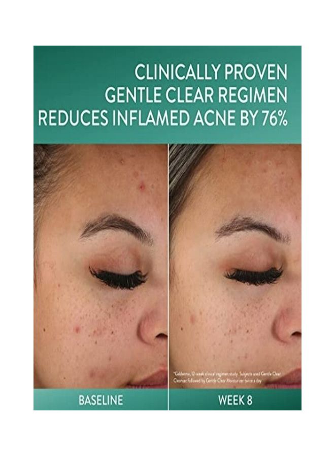 Gentle Clear Clarifying Acne Cream Cleanser Face Wash 124ml