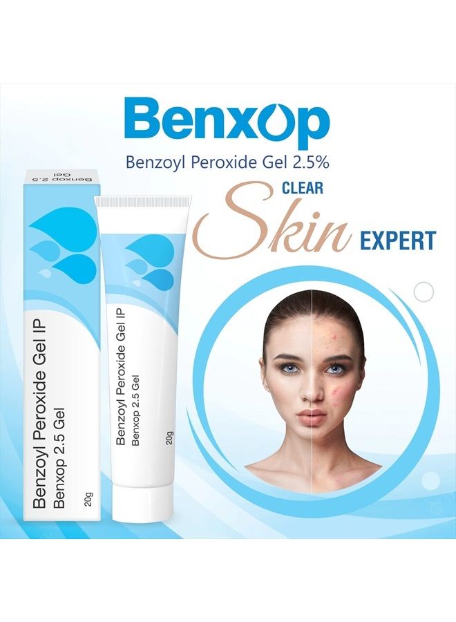 Benxop Benzoyl Peroxide 2.5% Pimples Cream 20gm (0.70 Fl Oz)