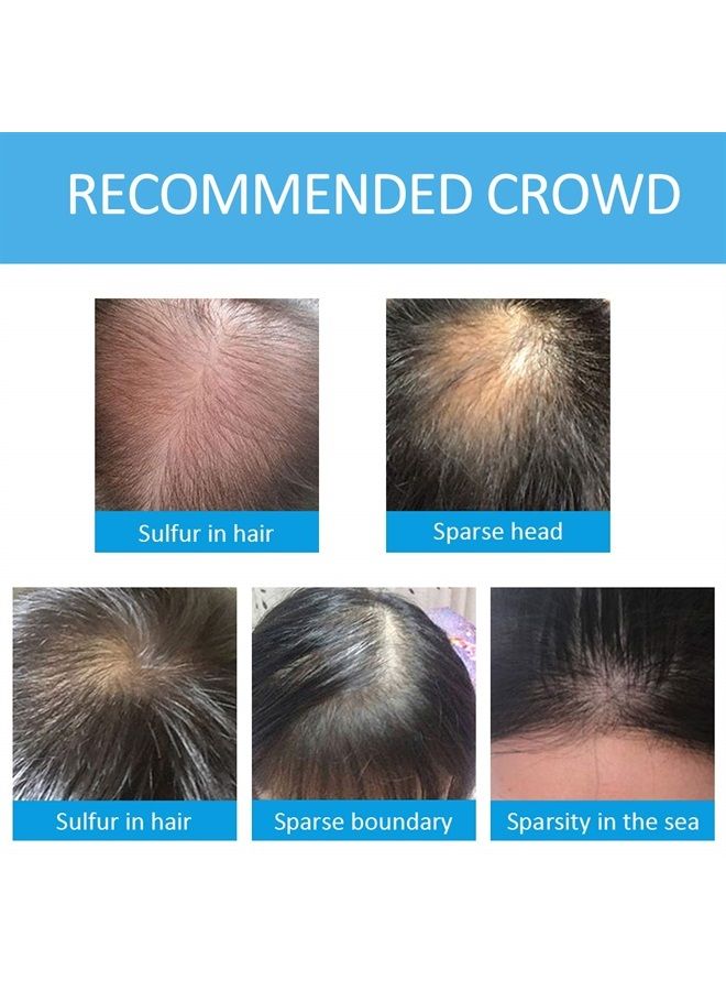 Hair Fibers for Thinning Hair Dark Brown, Hair Building Fibers for Men Women with Hair Fiber Spray Applicator, Hair Building Fibers Refill Thicker Hair in 15 Seconds, Conceals Hair Loss & Look Younger