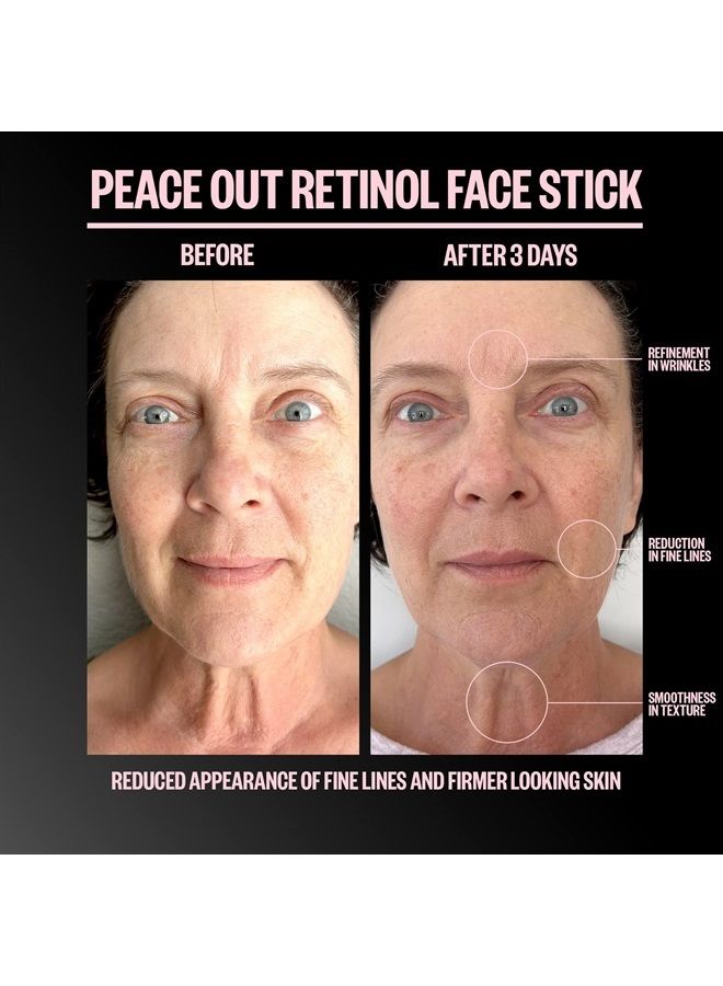 Skincare Retinol Face Stick. Reduce Fine Lines, Wrinkles and Uneven Texture with 3% Encapsulated Retinol (.28 oz)
