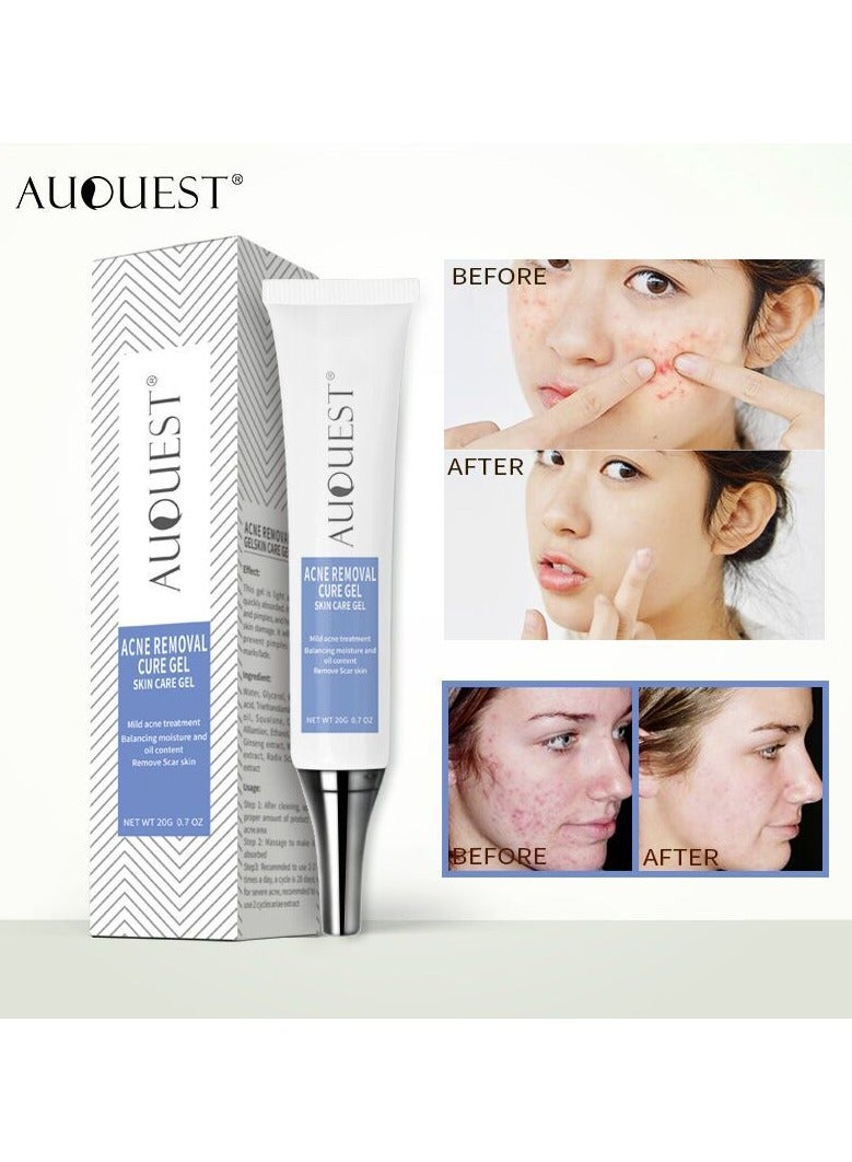 AUQUEST spot gentle repair acne pits and acne marks, fade blackheads, pores, moisturizing acne gel cream