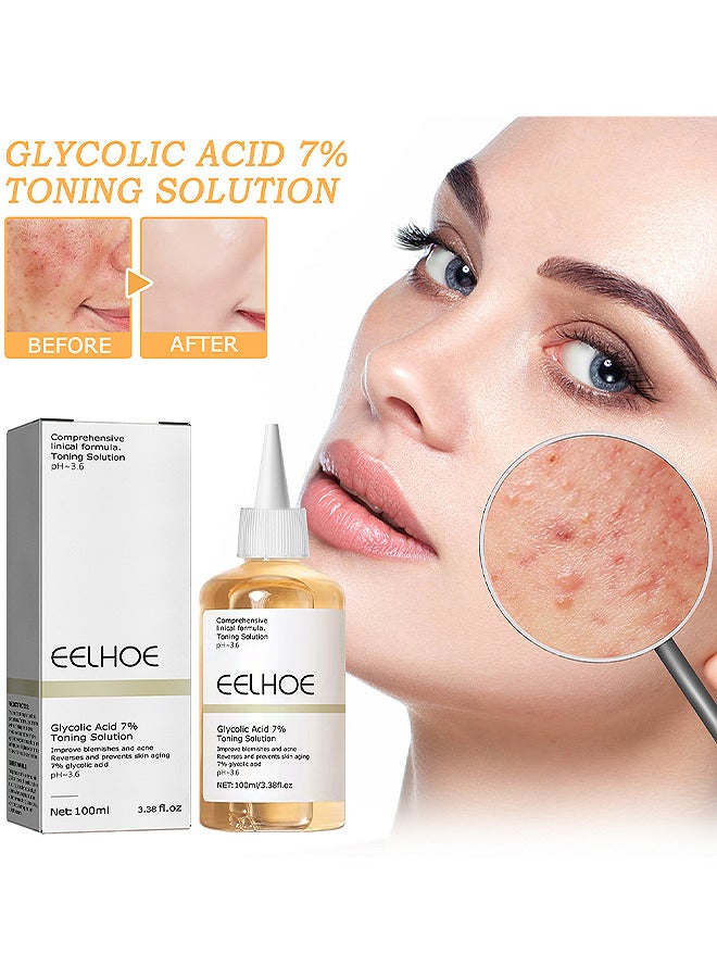 Glycolic Acid 7% Toning Solution For Removing Acne, Reducing Acne Marks, Removing Closed Mouth Acne And Repairing The Skin 100ML