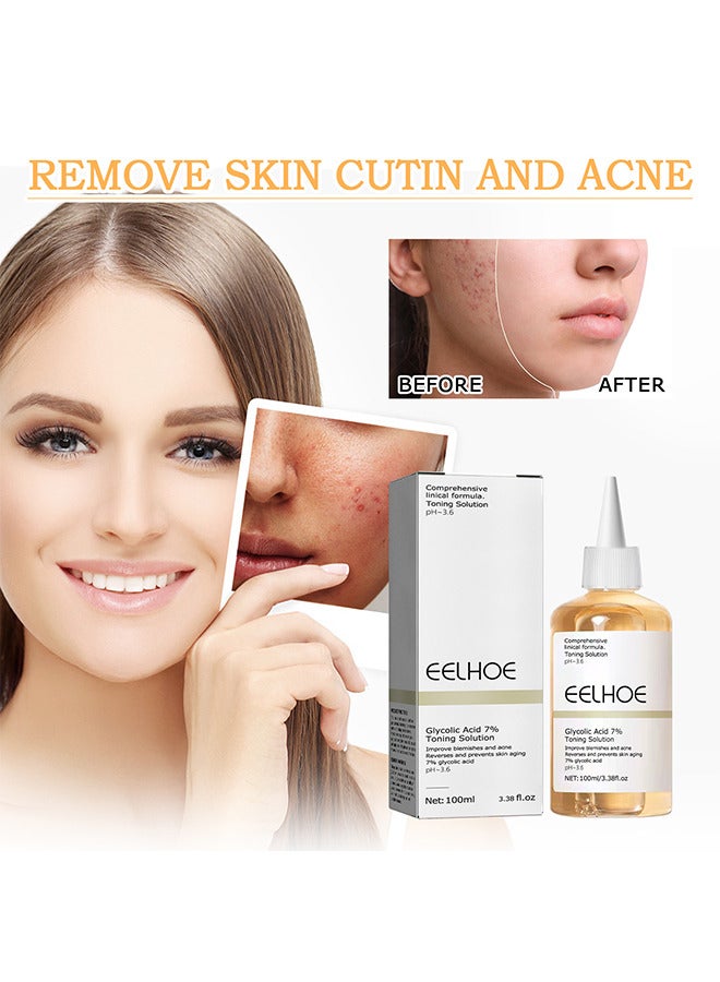 Glycolic Acid 7% Toning Solution For Removing Acne, Reducing Acne Marks, Removing Closed Mouth Acne And Repairing The Skin 100ML