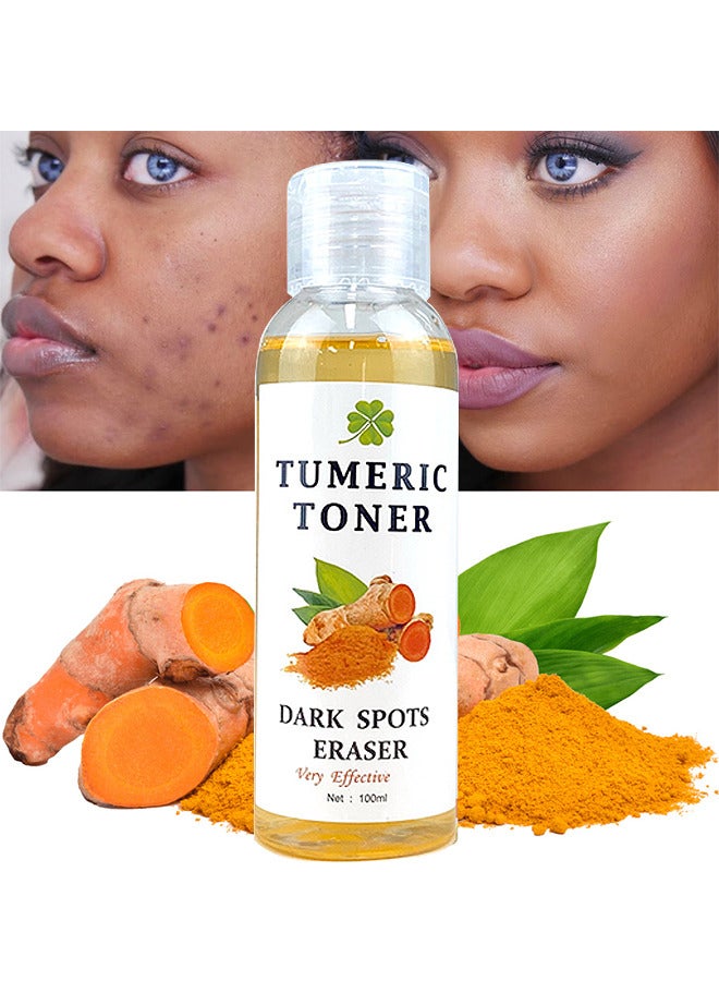 Turmeric Dark Spot Corrector Toner 100ML Facial Toner For Acne Prone Skin Dark Spot Remover For Face Hydrating Face Toner For Women Treatment