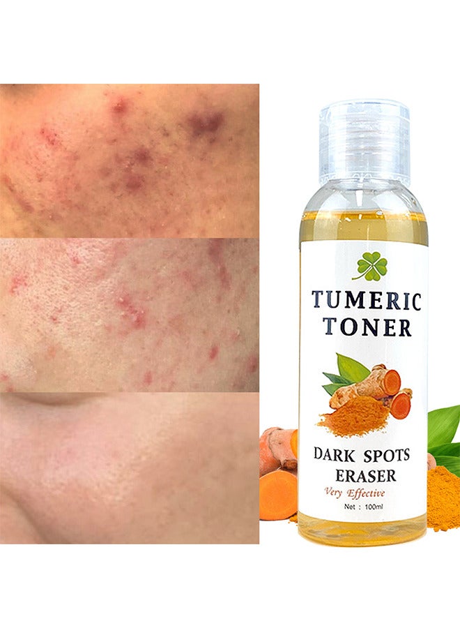 Turmeric Dark Spot Corrector Toner 100ML Facial Toner For Acne Prone Skin Dark Spot Remover For Face Hydrating Face Toner For Women Treatment