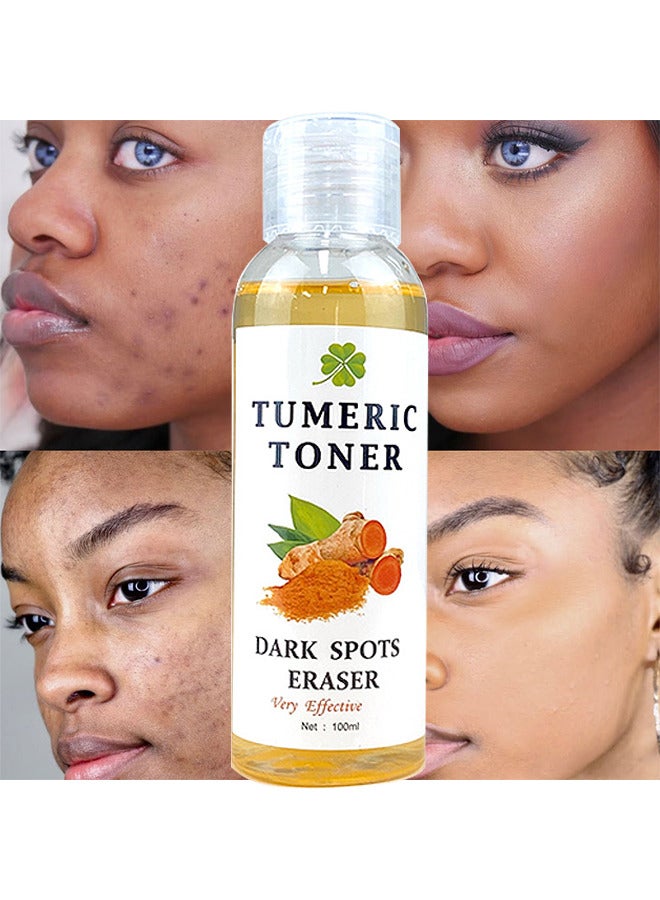 Turmeric Dark Spot Corrector Toner 100ML Facial Toner For Acne Prone Skin Dark Spot Remover For Face Hydrating Face Toner For Women Treatment