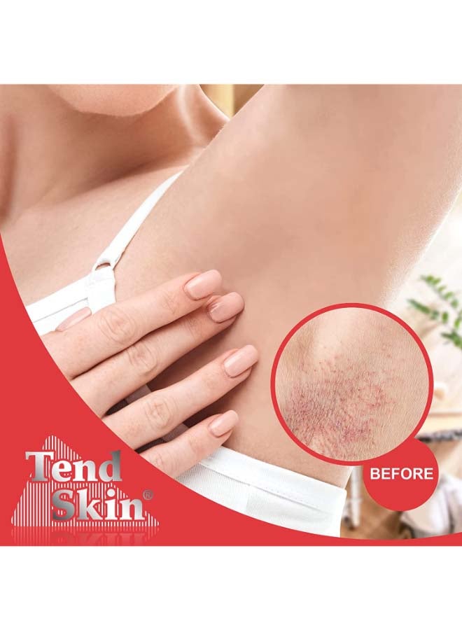 The Skin Care Solution For Ingrown Hair And Razor Burns