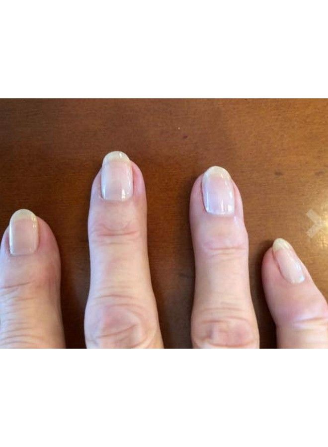 Deep Nutrition Nails Strengthener & 7 In 1 Elixir Nail Treatment Makes Your Nails Stronger And Healty