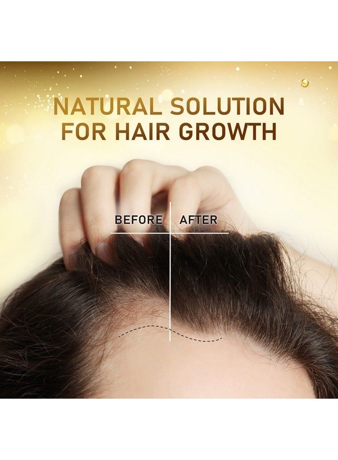 Biotin Hair Growth Serum With Castor Oil Argan Oil Hair Loss Prevention Treatment With Hair Regrowth Formula For Women By Beaueli