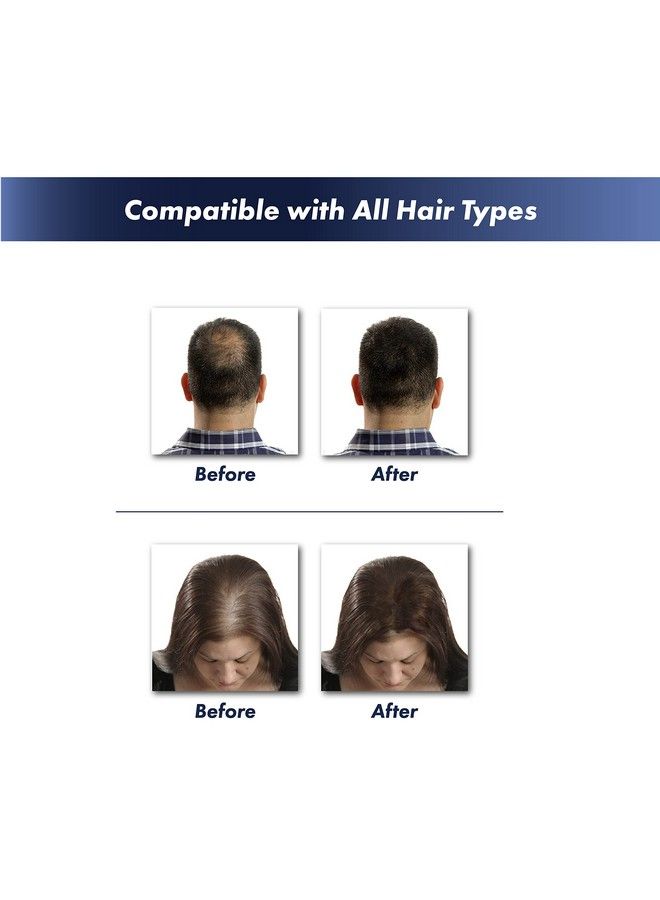 Hair Building Fibres - Natural Keratin Hair Thickener Fibres Hair Powder For Men And Women Full Head Of Hair In 30 Seconds-Hair Fibres Black