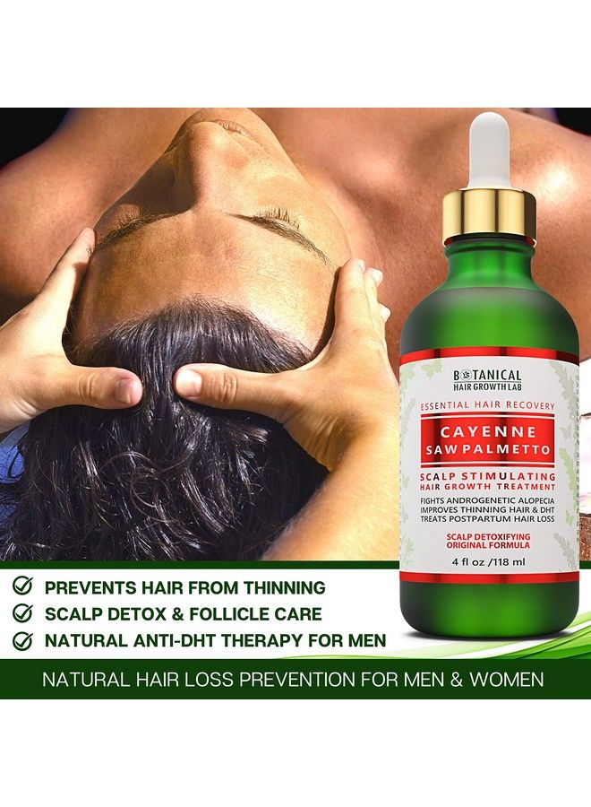 Cayenne Saw Palmetto Scalp Stimulating Treatment Natural Antihair Loss Complex Dht Blocker 4 Ounce (Pack Of 1)