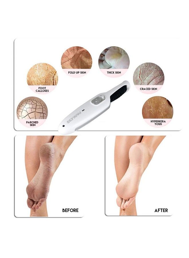 Foot Filer For Dry Dead Hard Skin & Calluses Spa Quality Home Pedicure Foot Care Tool For Men & Women