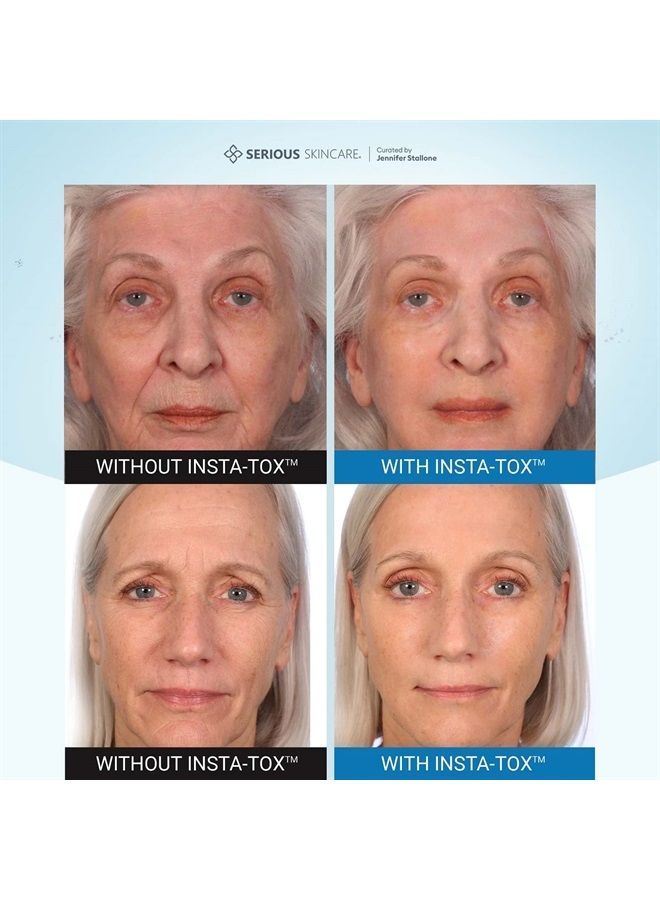 INSTA-TOX Instant Wrinkle Smoothing Serum - Tightens Skin - Facial Serum - Instant Line Filler - .75 oz. (1-Pack)