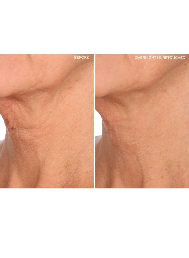 Beauty Facelift ; Neck Forehead Eye & Smile Antiwrinkle Patches ; Overnight Smoothing Silicone Patches For Face Neck Forehead Eye & Smile Fine Lines And Signs Of Aging