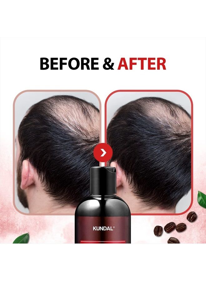 KUNDAL Baby Powder Anti-Hair Loss & Caffein Scalp Care Deep Cleansing For Hair Loss Shampoo 10.14 Fl Oz